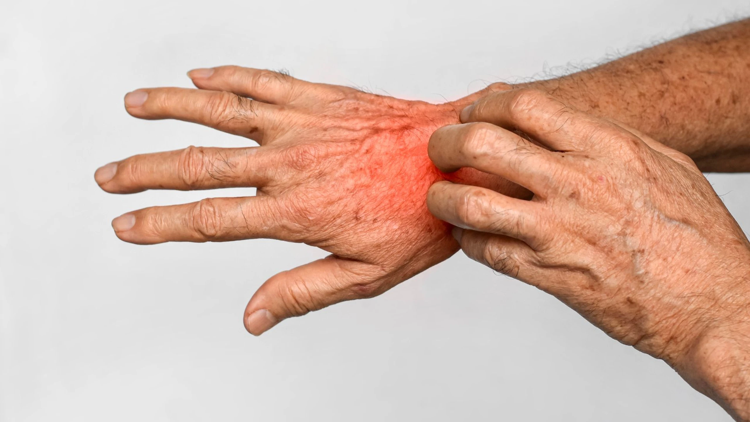 benh_a_z_ghe_33bd98907c