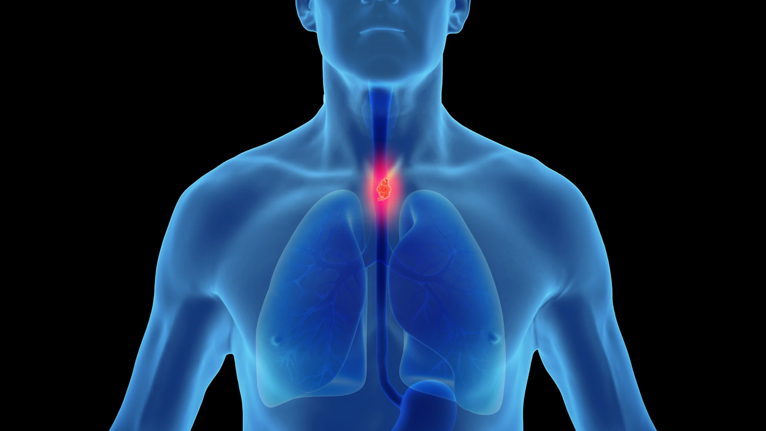 benh_a_z_hep_thuc_quan_a759cefb0a