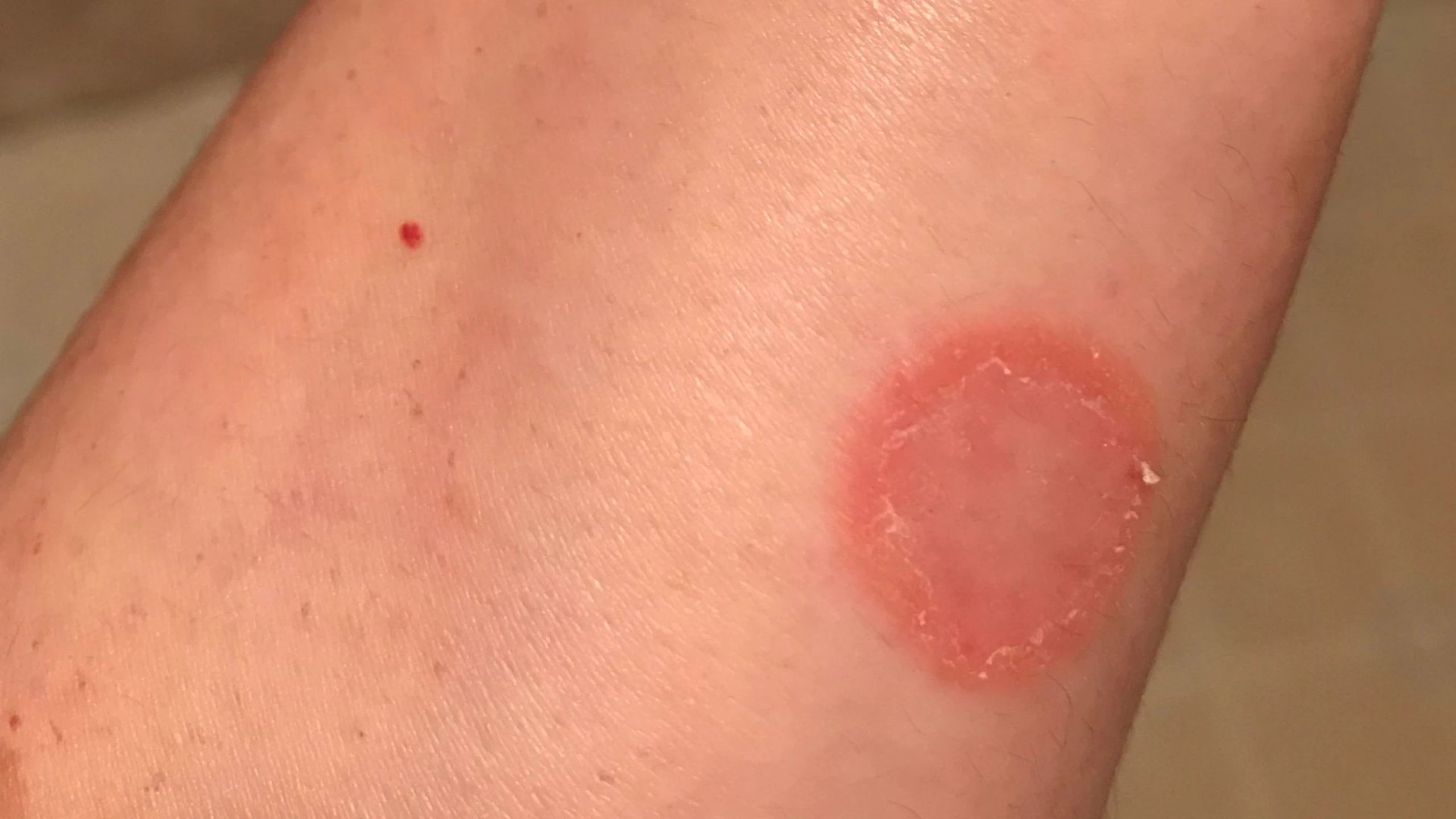 benh_a_z_lac_dong_tien_1_68462cad50