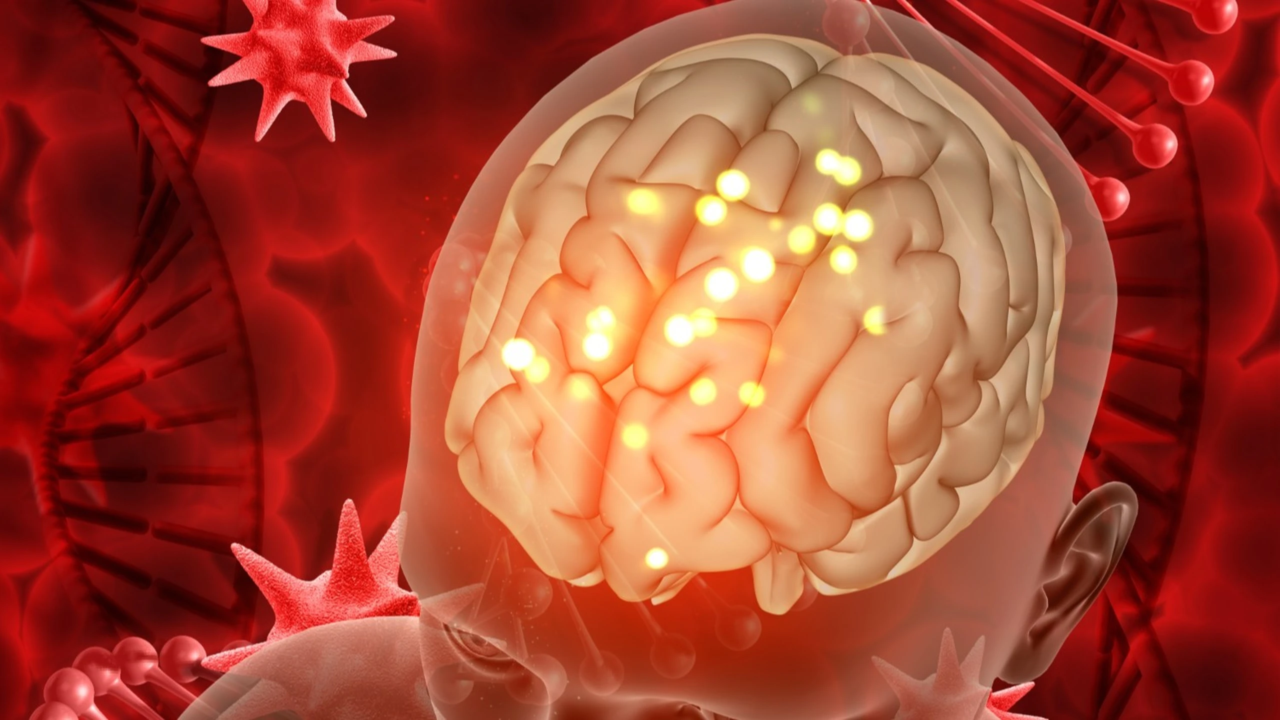 benh_a_z_nhiem_khuan_huyet_nao_mo_cau_ebbb015be8