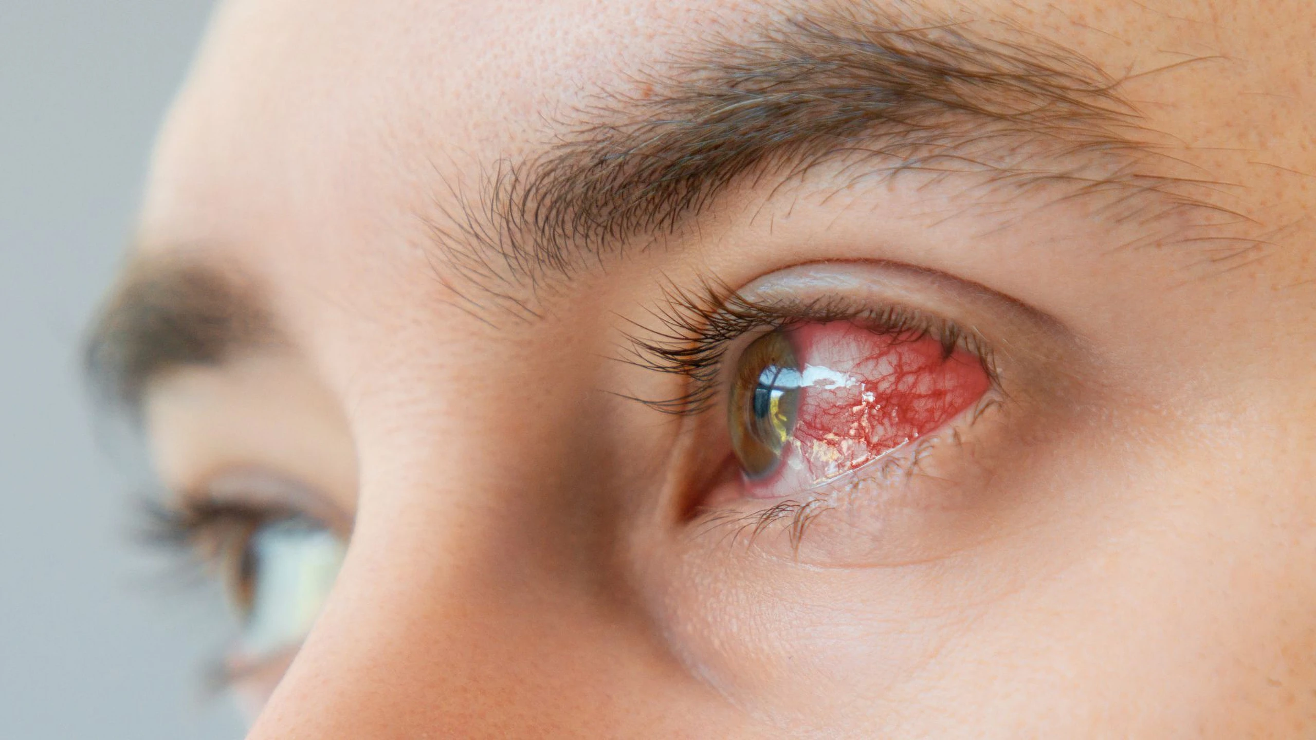 benh_a_z_rach_giac_mac_1_d59bd06b89