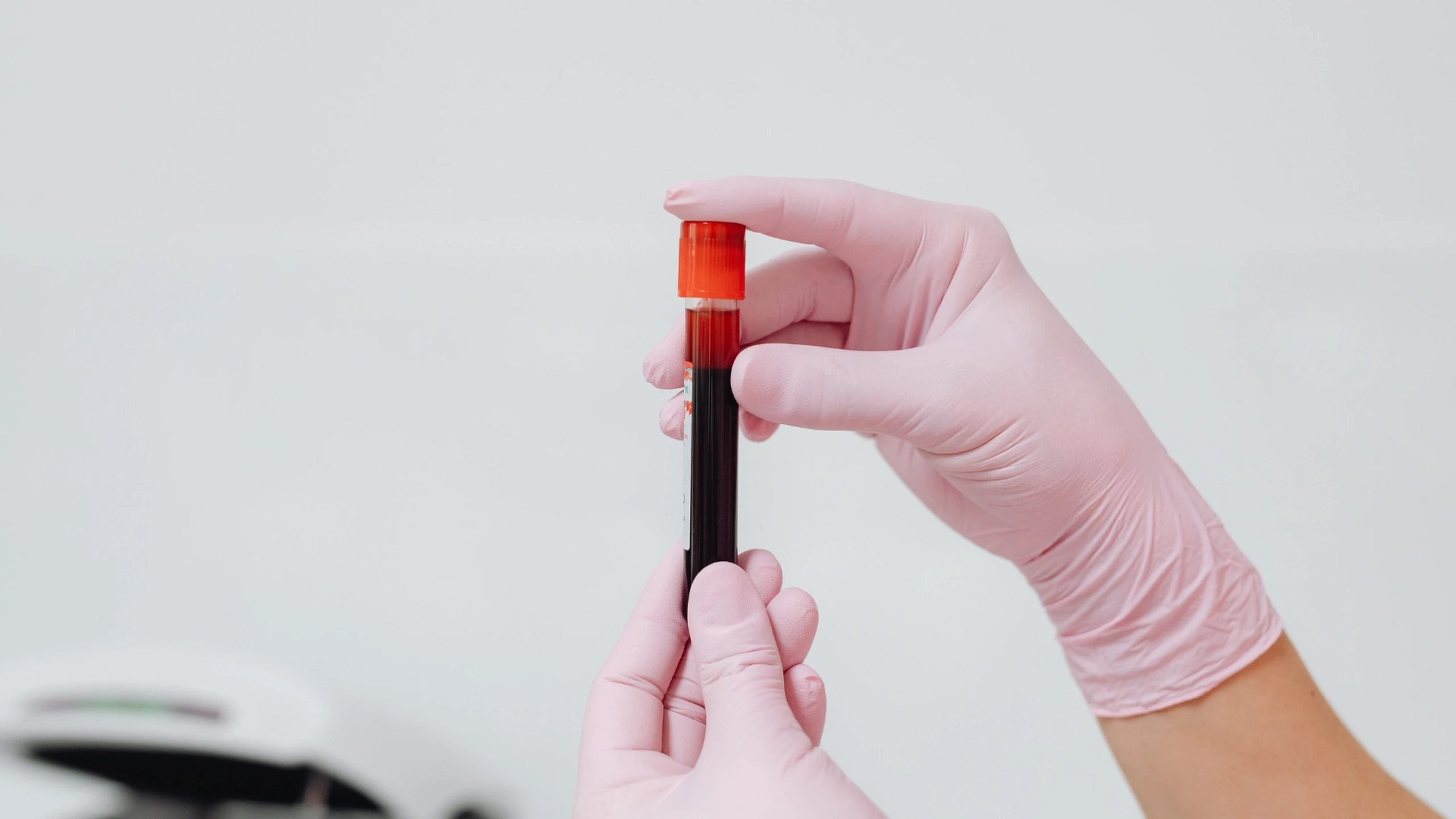 benh_a_z_tieu_cau_thap_0_4e5cf978a5