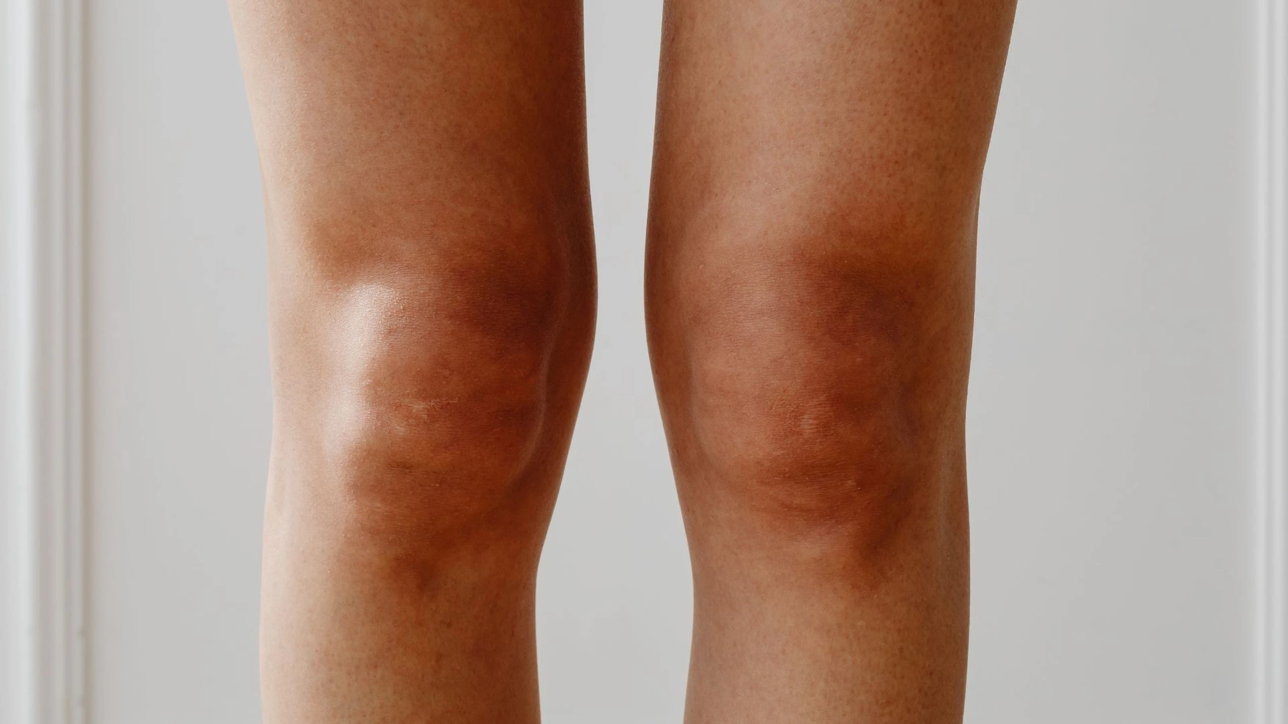 benh_a_z_tran_dich_khop_goi_0447ba218f