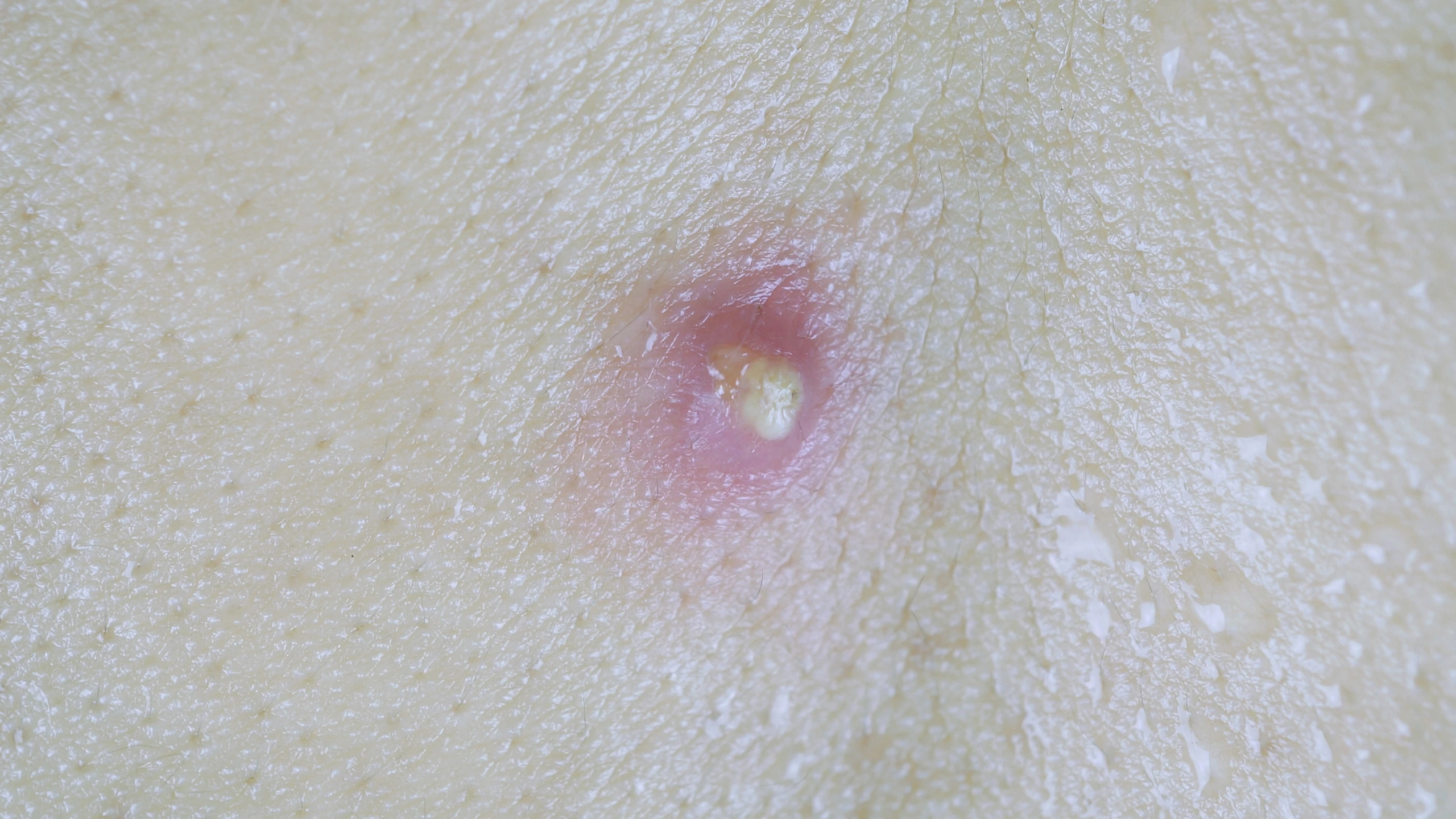 benh_a_z_u_ba_dau_0_912adb80d0