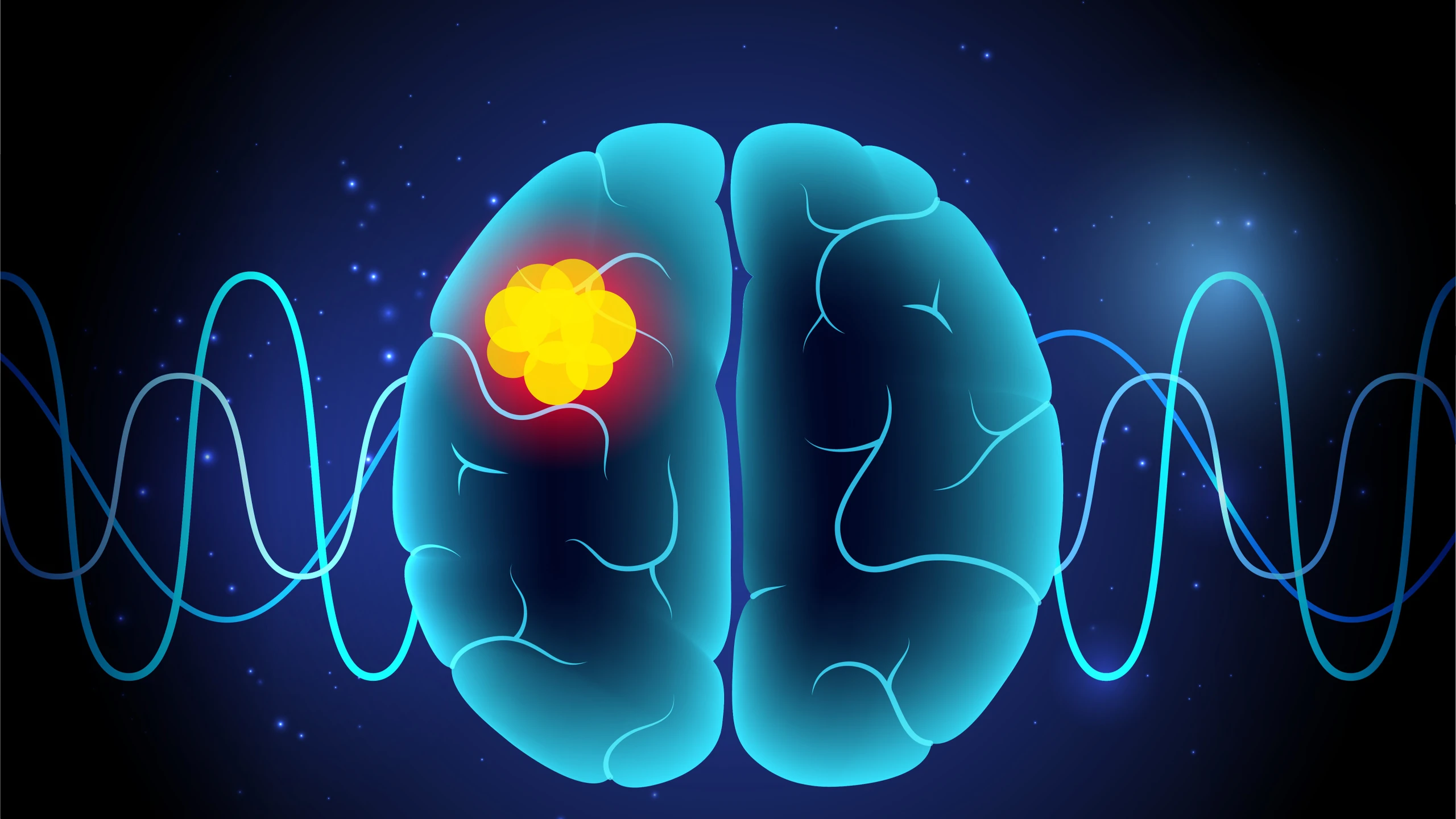 benh_a_z_u_mang_nao_563f2a9726