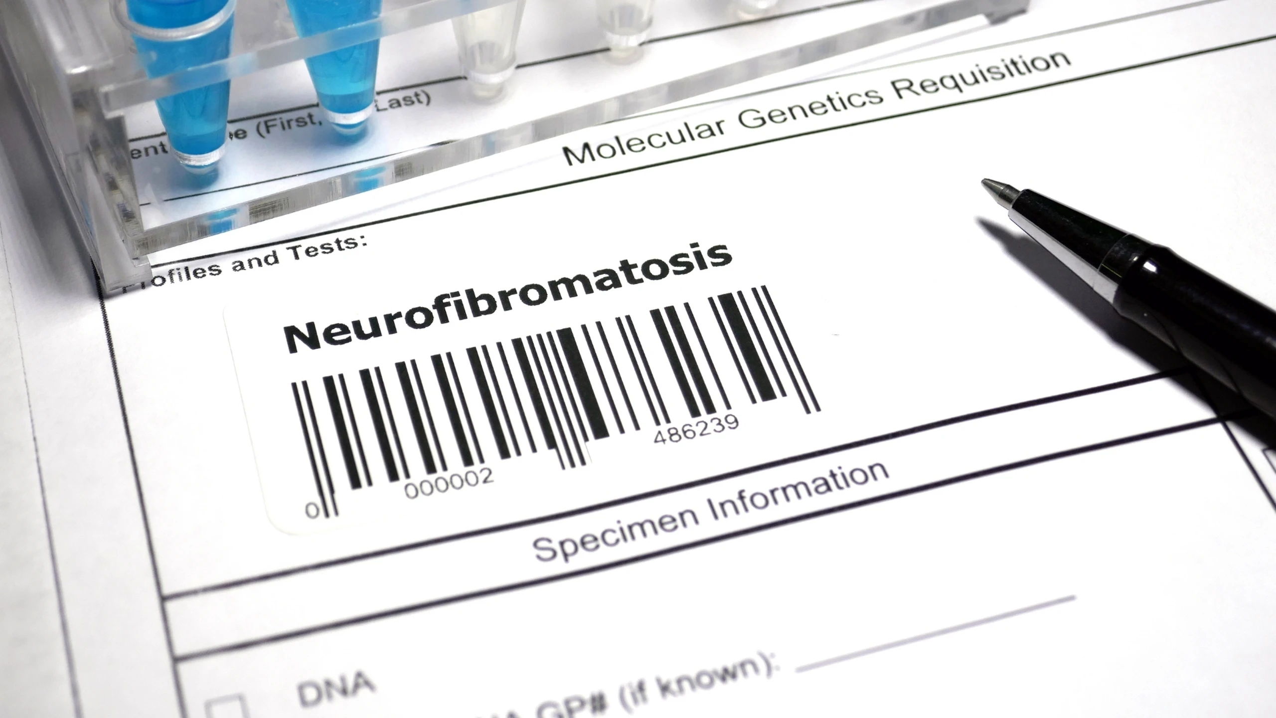 benh_a_z_u_xo_than_kinh_type_1_1_97b2207d7e