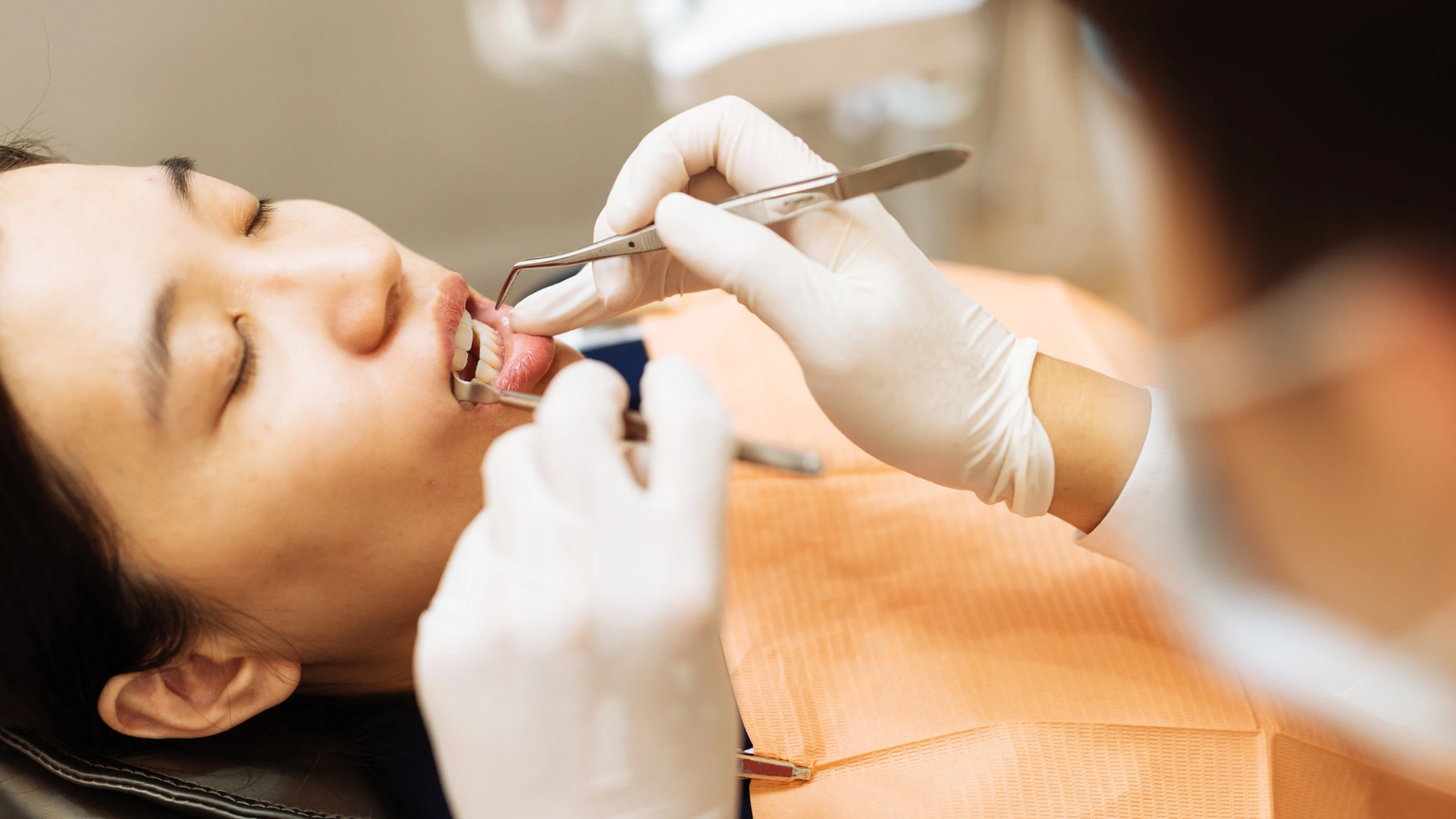 benh_a_z_viem_nha_chu_aeaaa514be