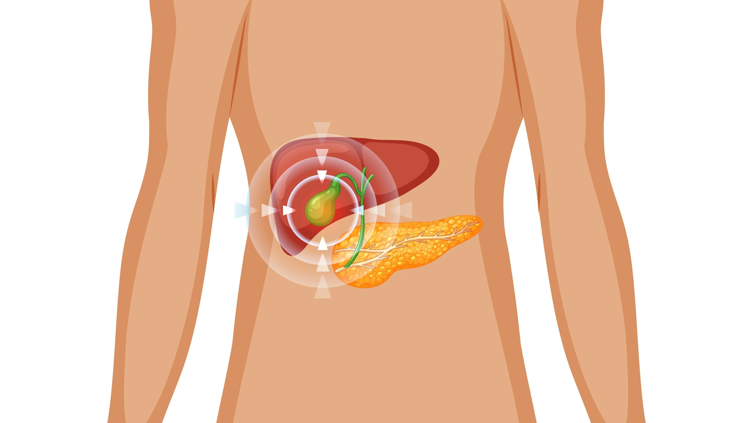 benh_a_z_viem_tui_mat_cap_eb3cc370ee