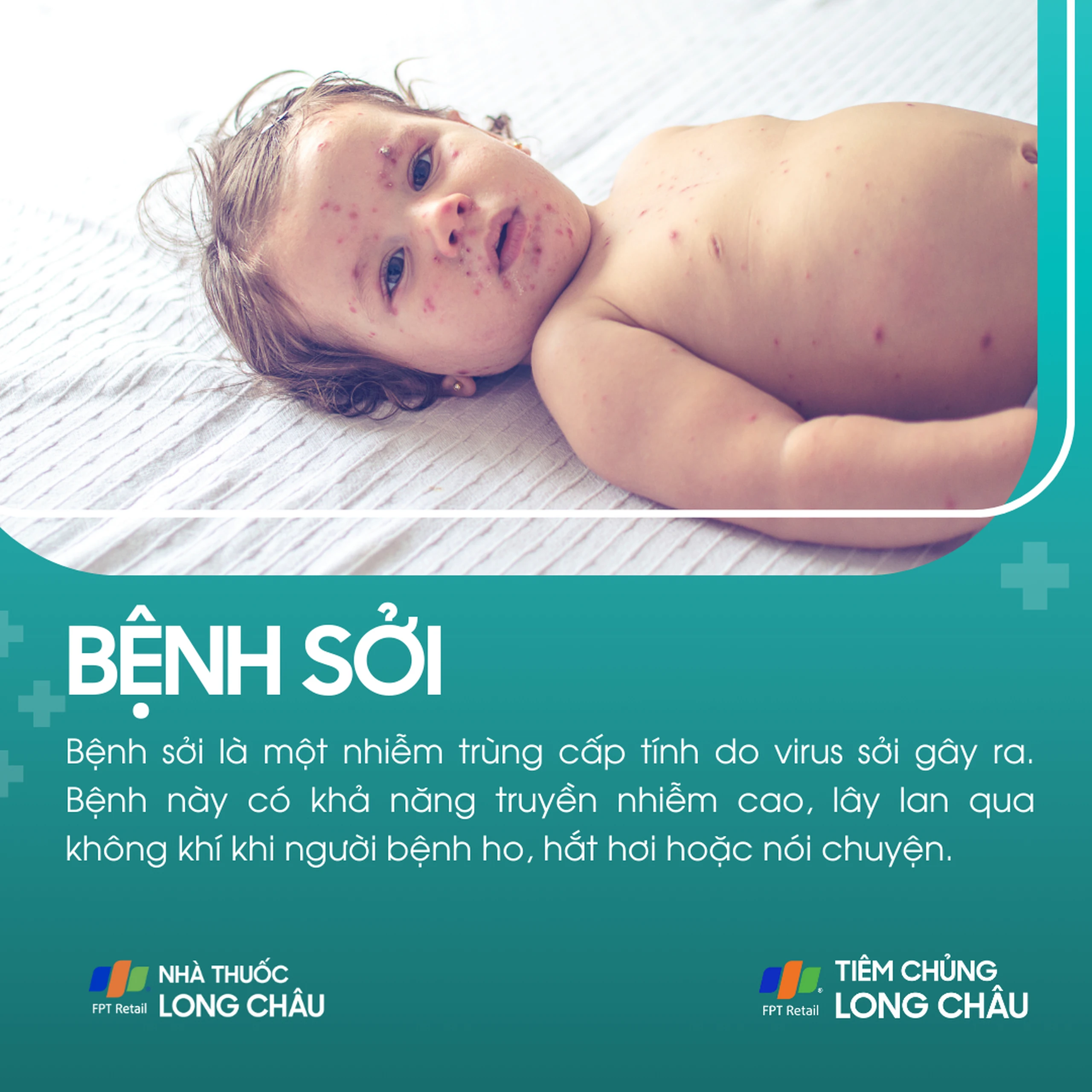 benh_soi_1_74c2bf408a