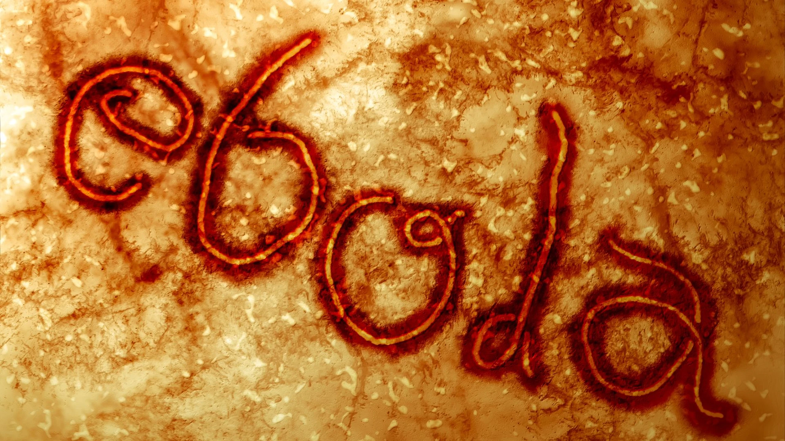 Dịch Ebola đang diễn biến ra sao? Cập nhập tình hình dịch Ebola
