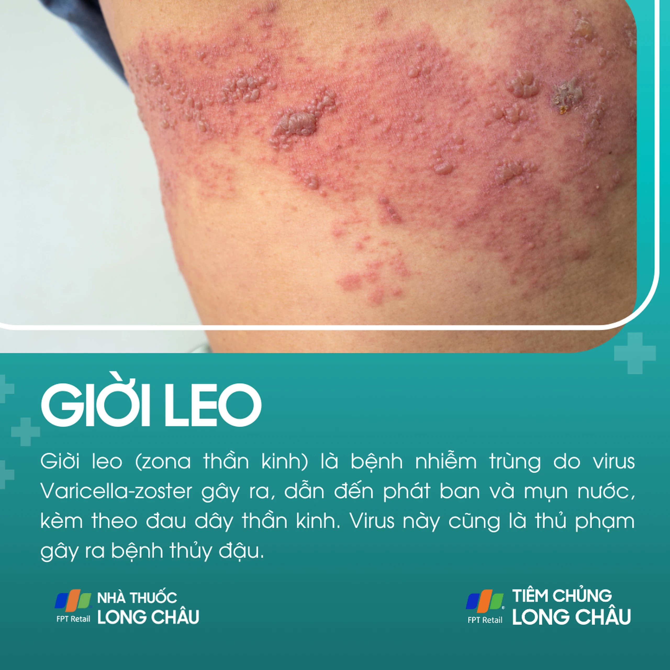 gioi_leo_1_31834c22c6