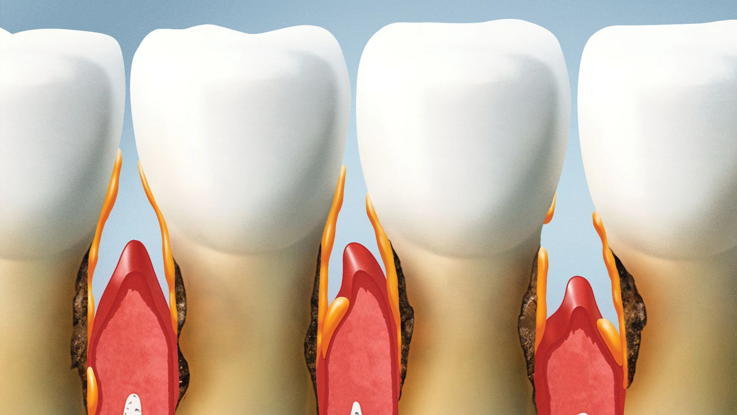 mon_co_chan_rang_1b8c01bd0d