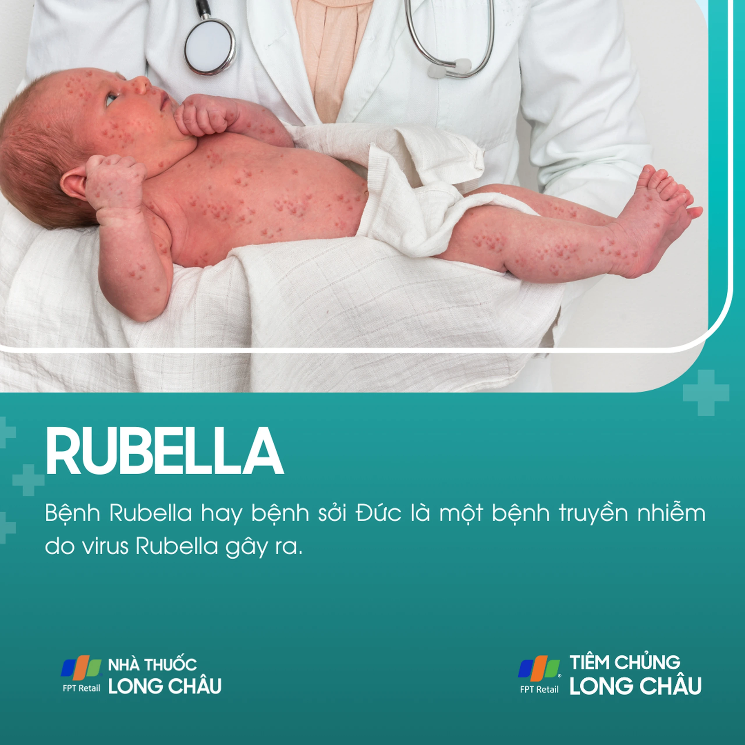 rubella_1_67bcc43235
