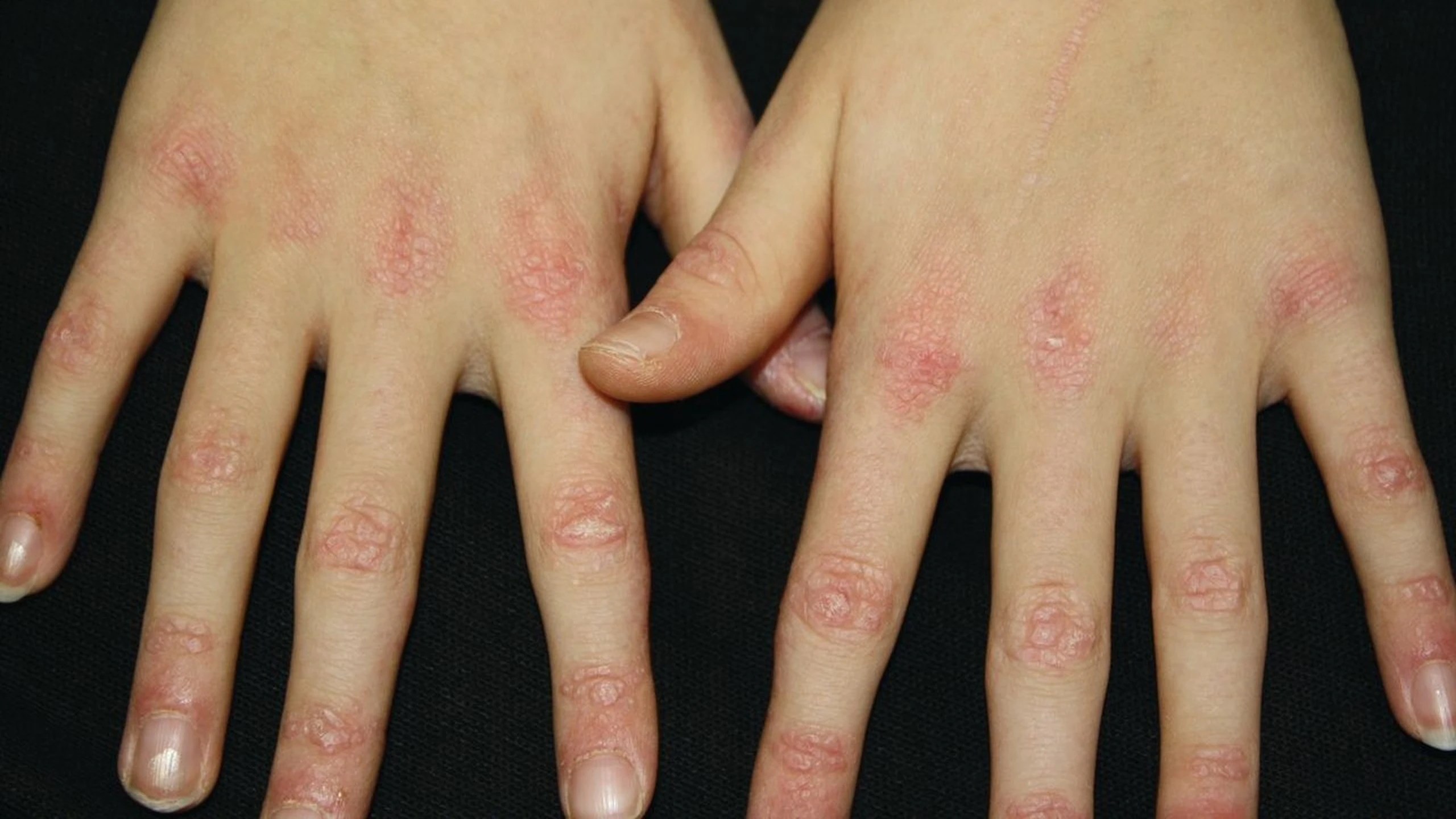 san_gottron_1_9f8dc97c56