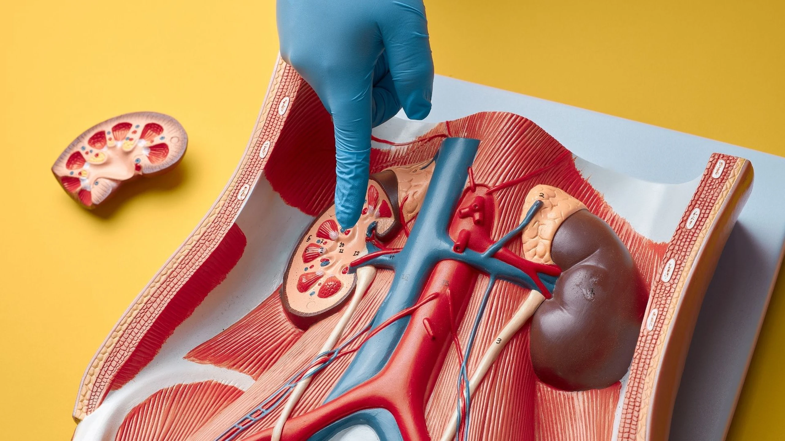 soi_nieu_quan_nguyen_nhan_gay_benh_va_phuong_phap_dieu_tri_phong_ngua_hieu_qua_f9221a83aa