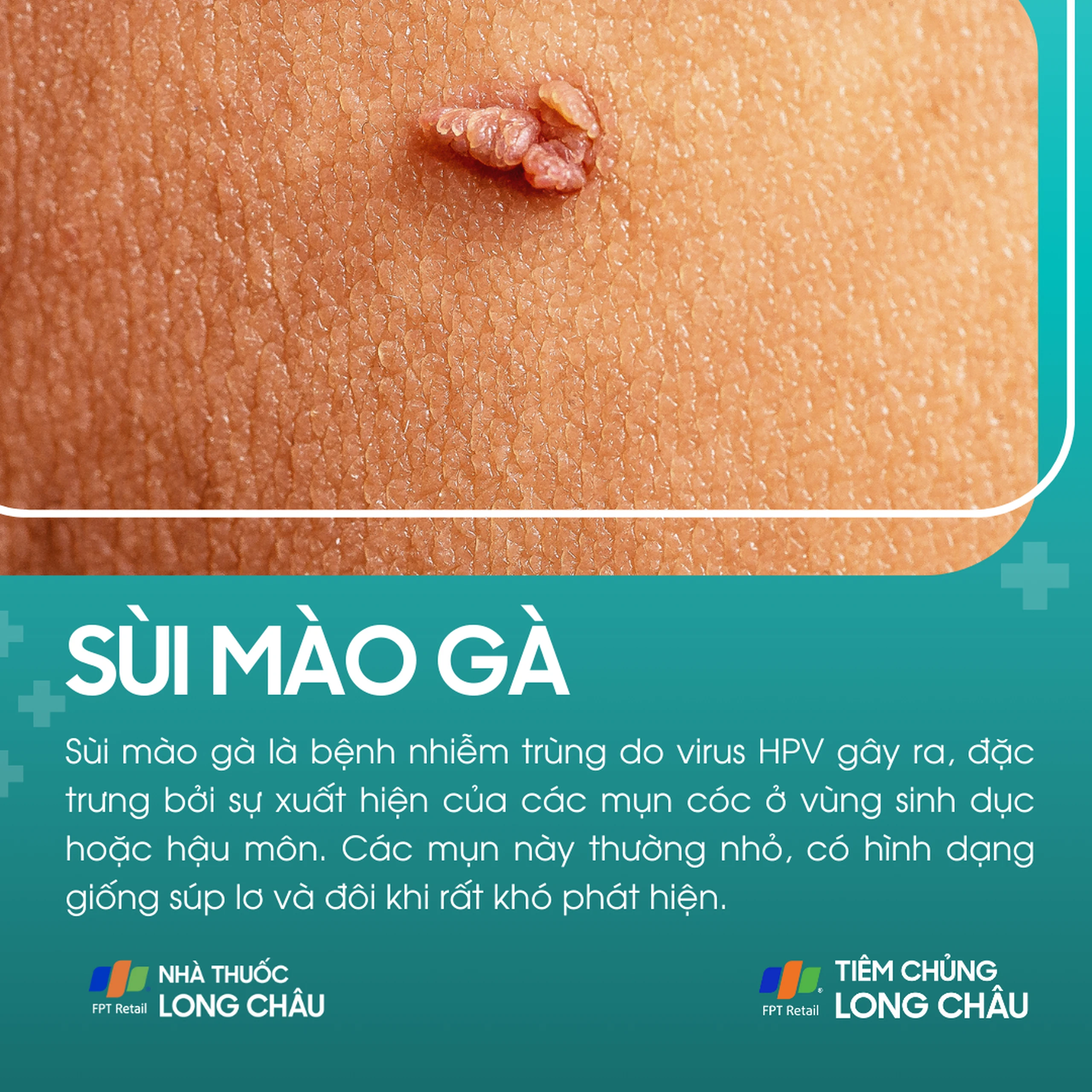 sui_mao_ga_1_0b1a139faf