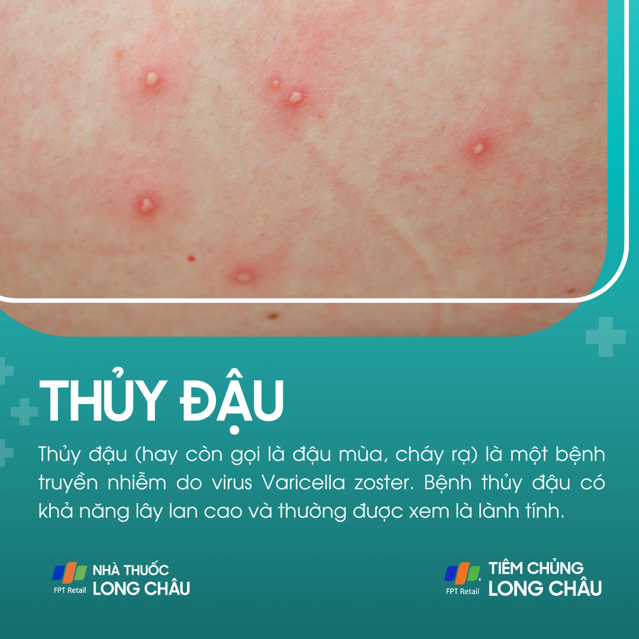 thuy_dau_1_f7fb7053b0