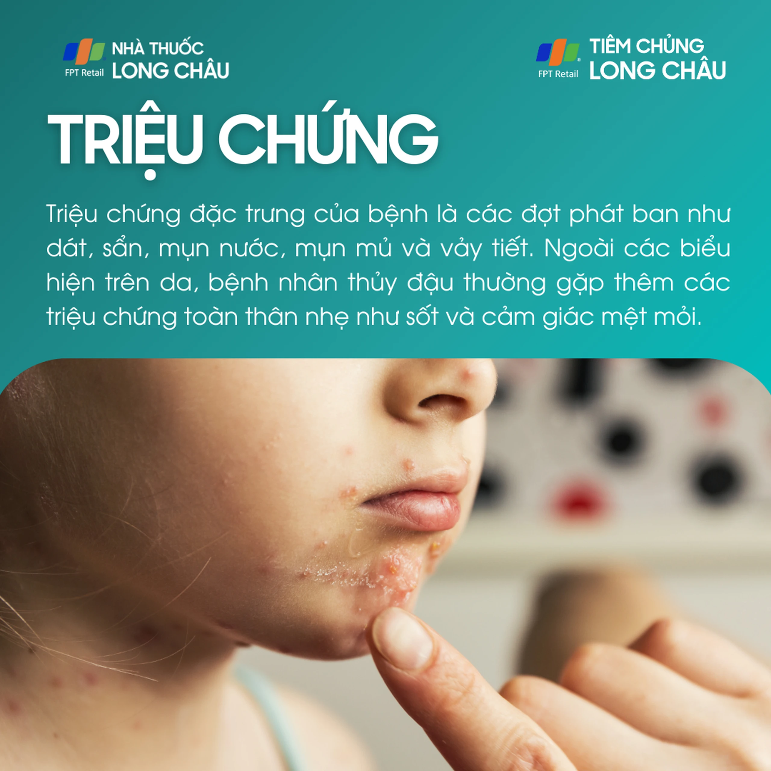 thuy_dau_2_31a6bc769e