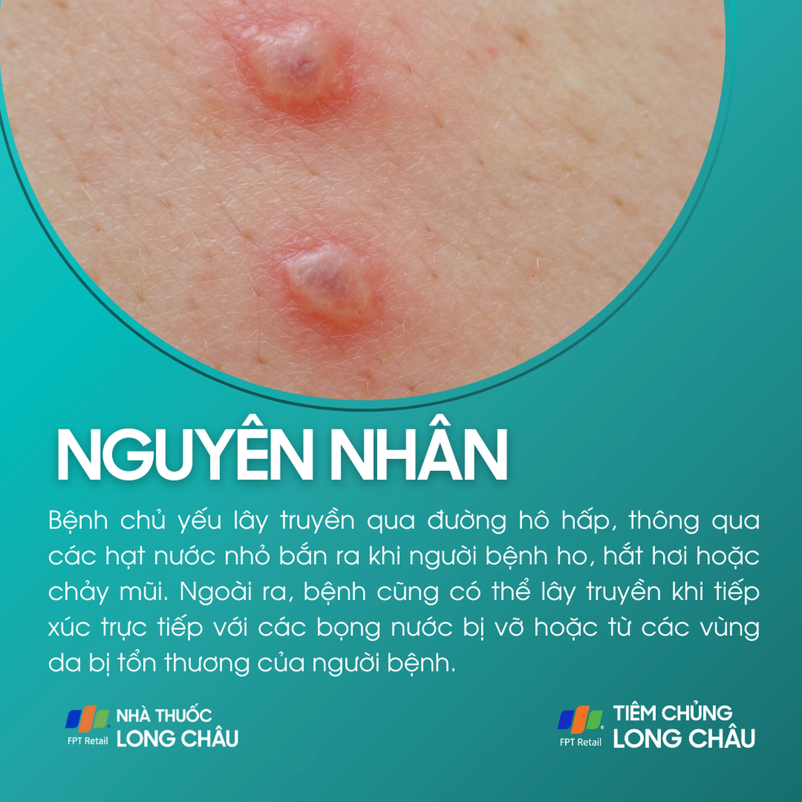 thuy_dau_3_cd70278973