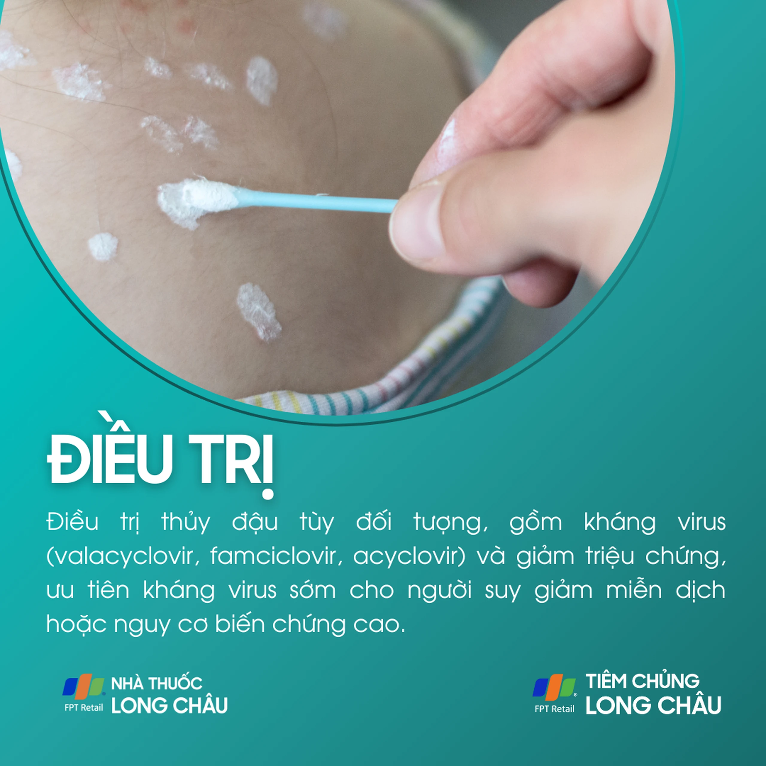 thuy_dau_6_818213b0c4