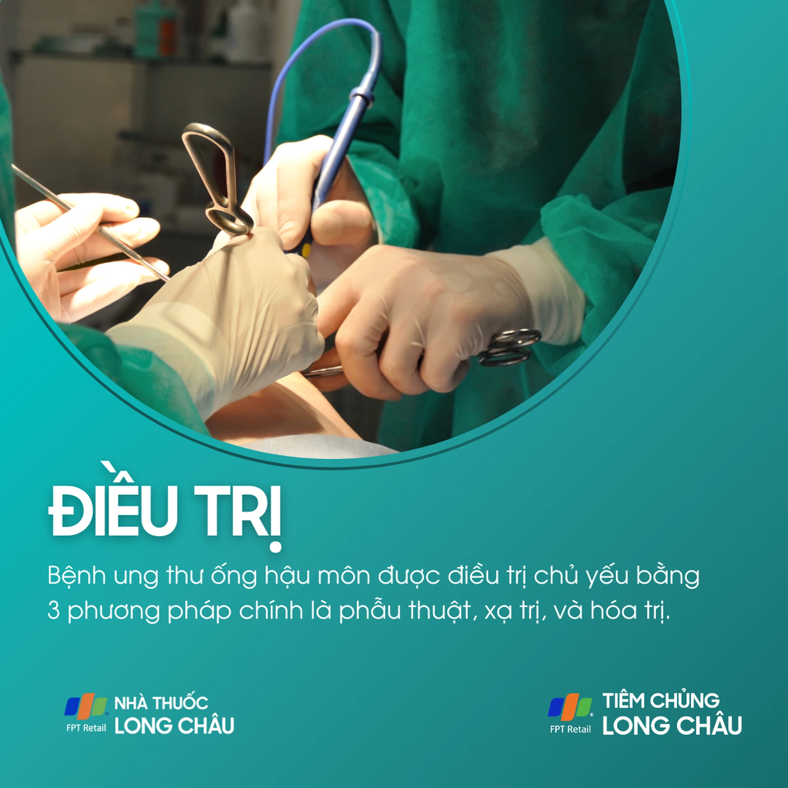 ung_thu_hau_mon_6_266ed7b8b9