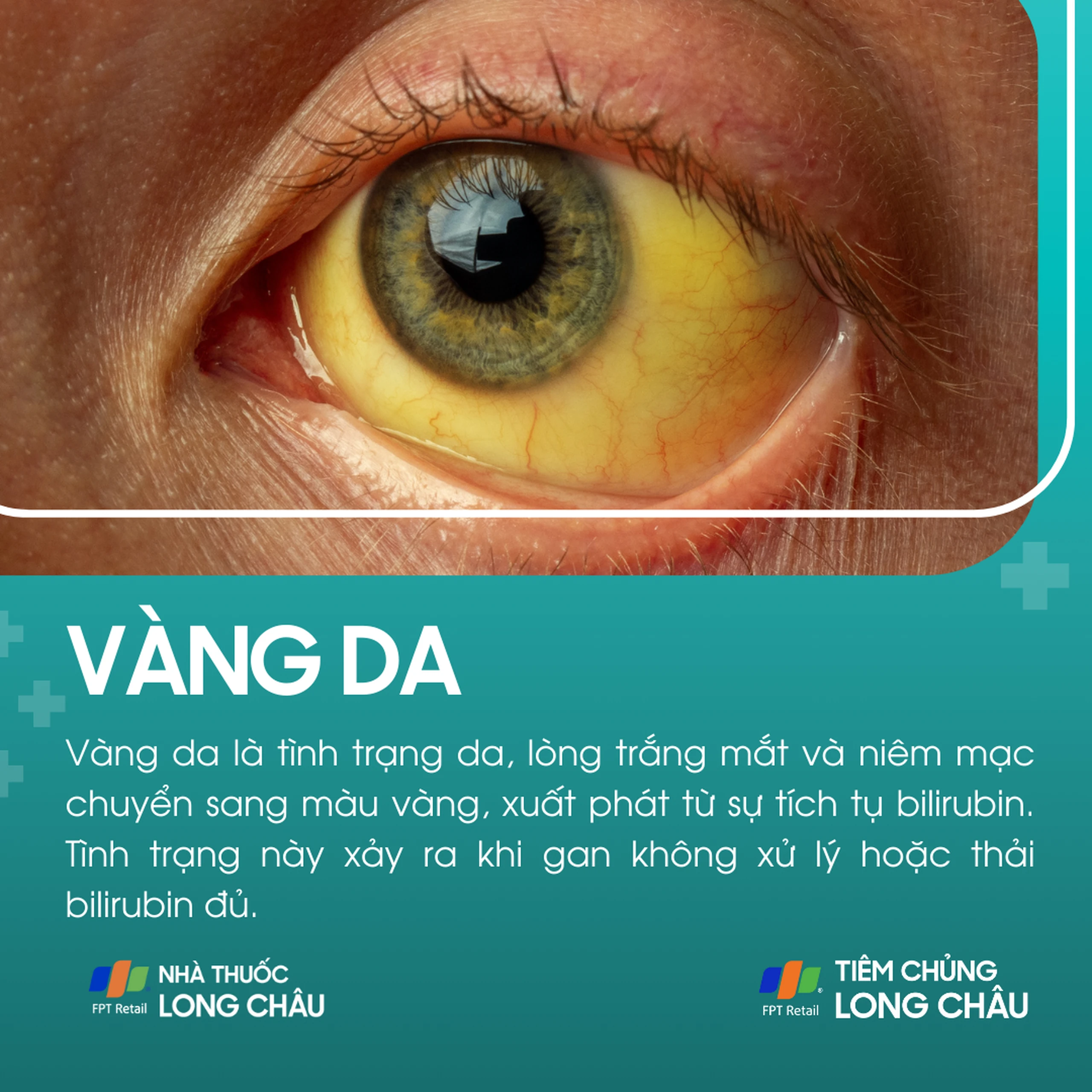 vang_da_1_6f6a0a642c