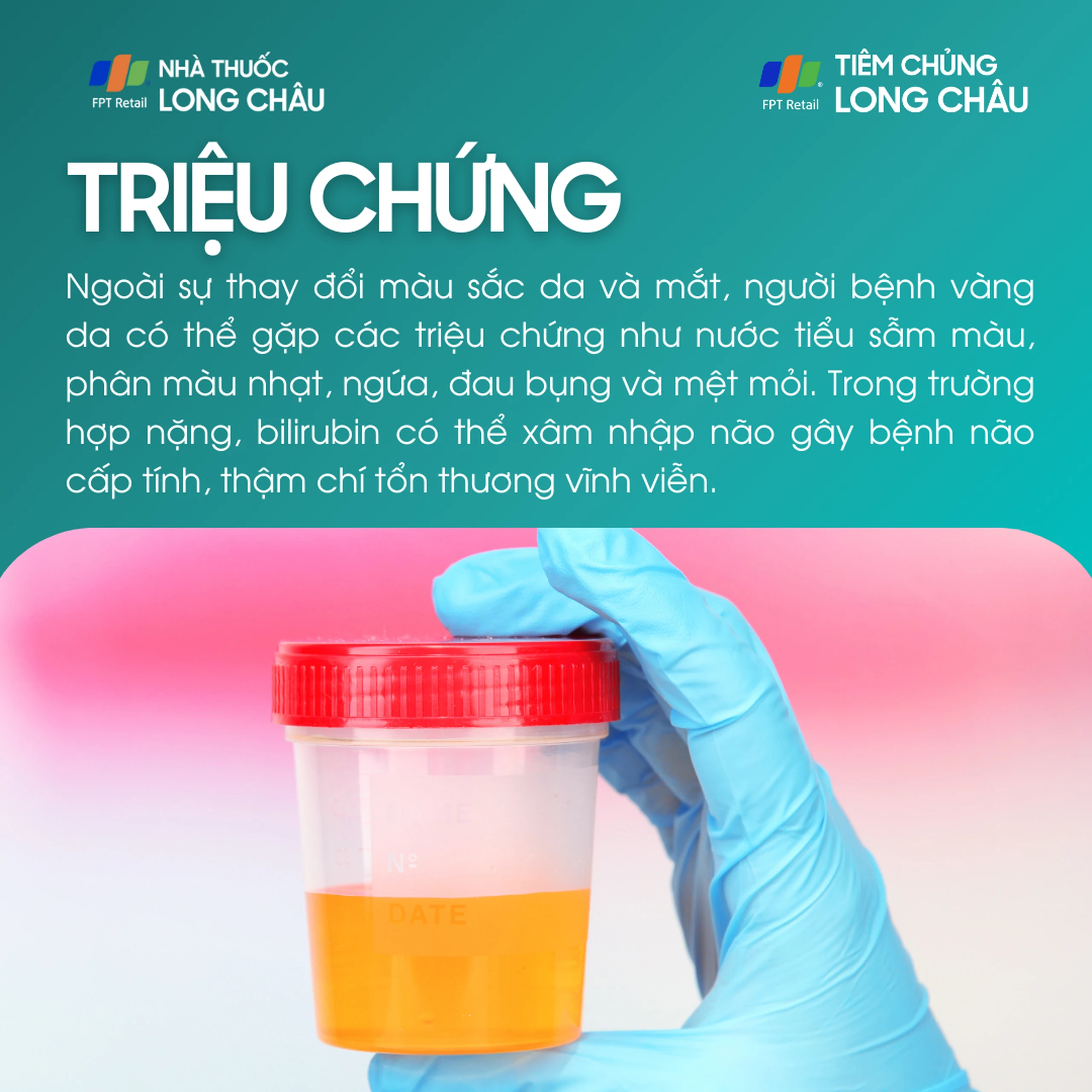 vang_da_2_1dc8df1356