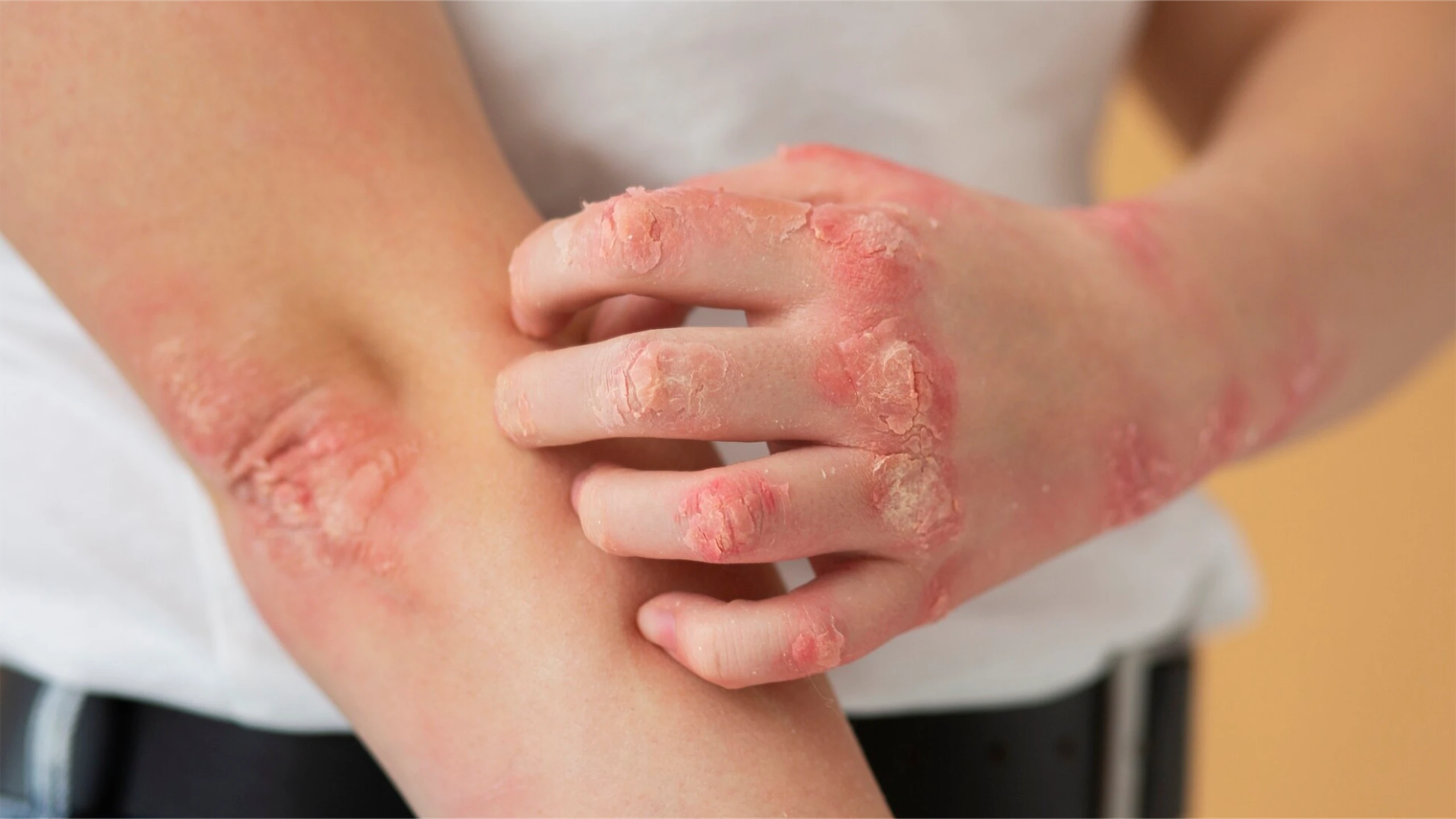 viem_bi_co_ef82167fa1