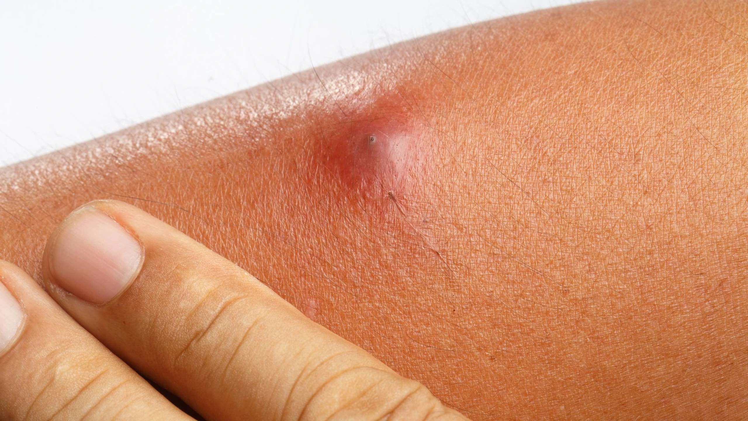 viem_da_mu_e122c6684b