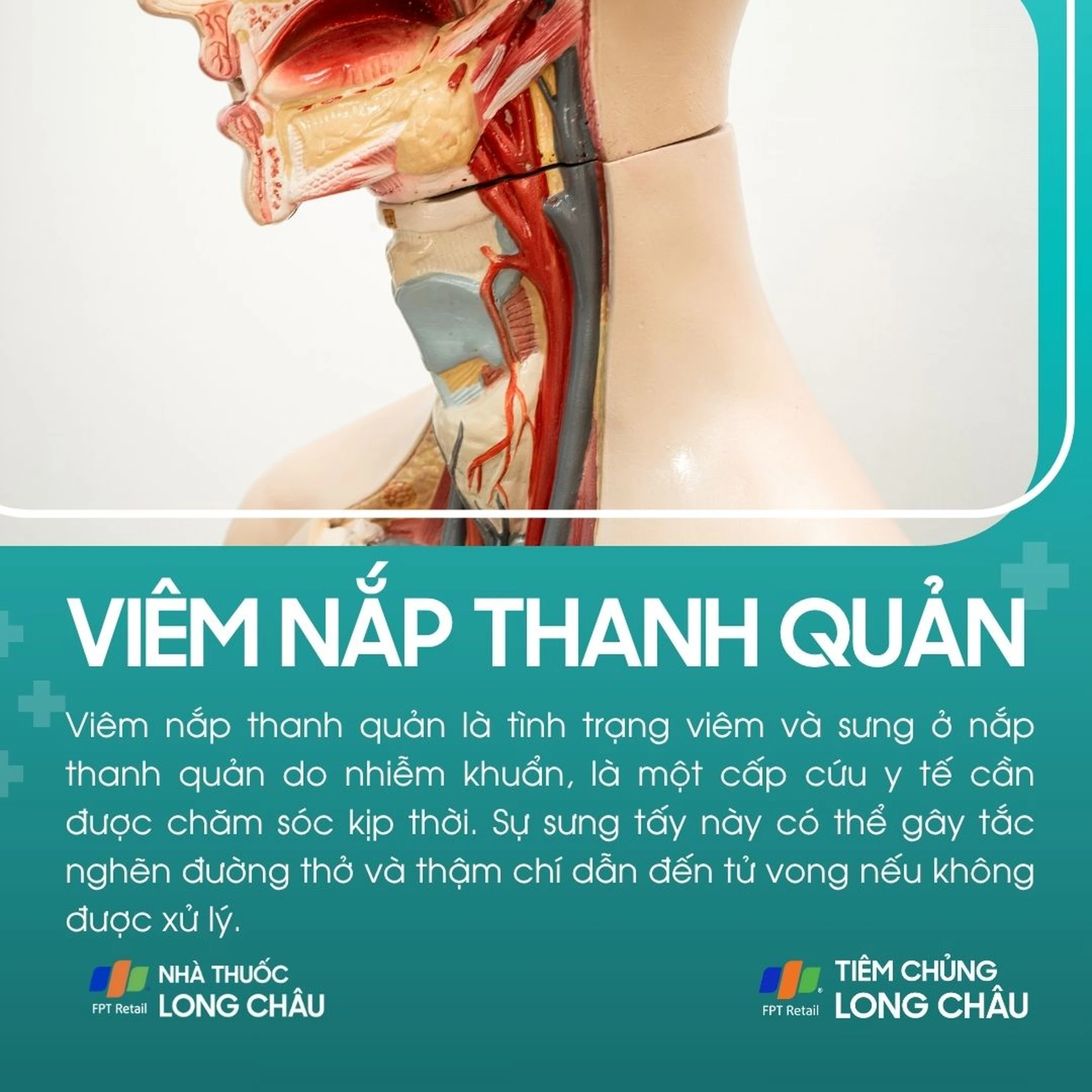 viem_nap_thanh_quan_1_8443c3fe5b