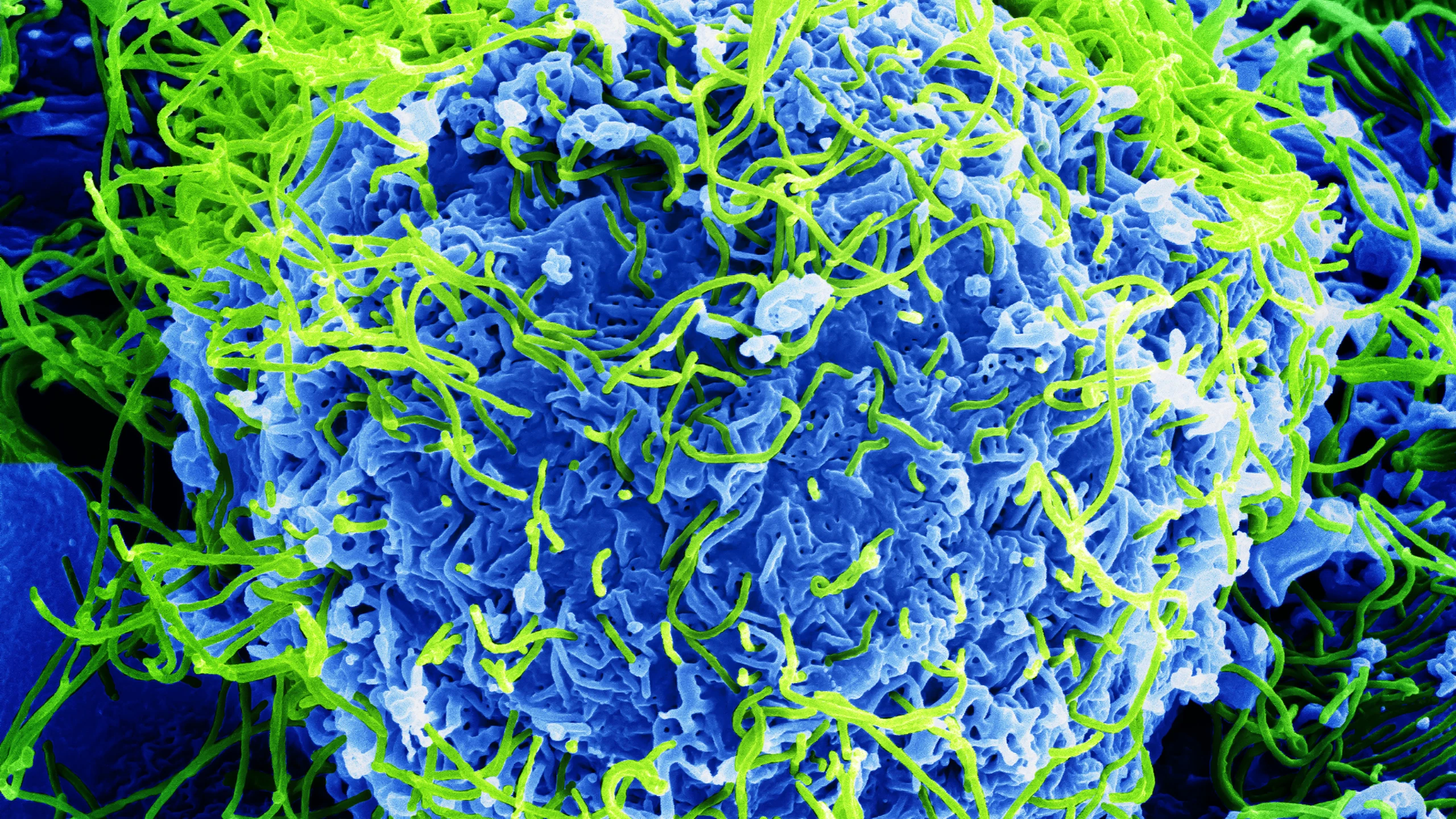 Virus Ebola có nguy hiểm không?