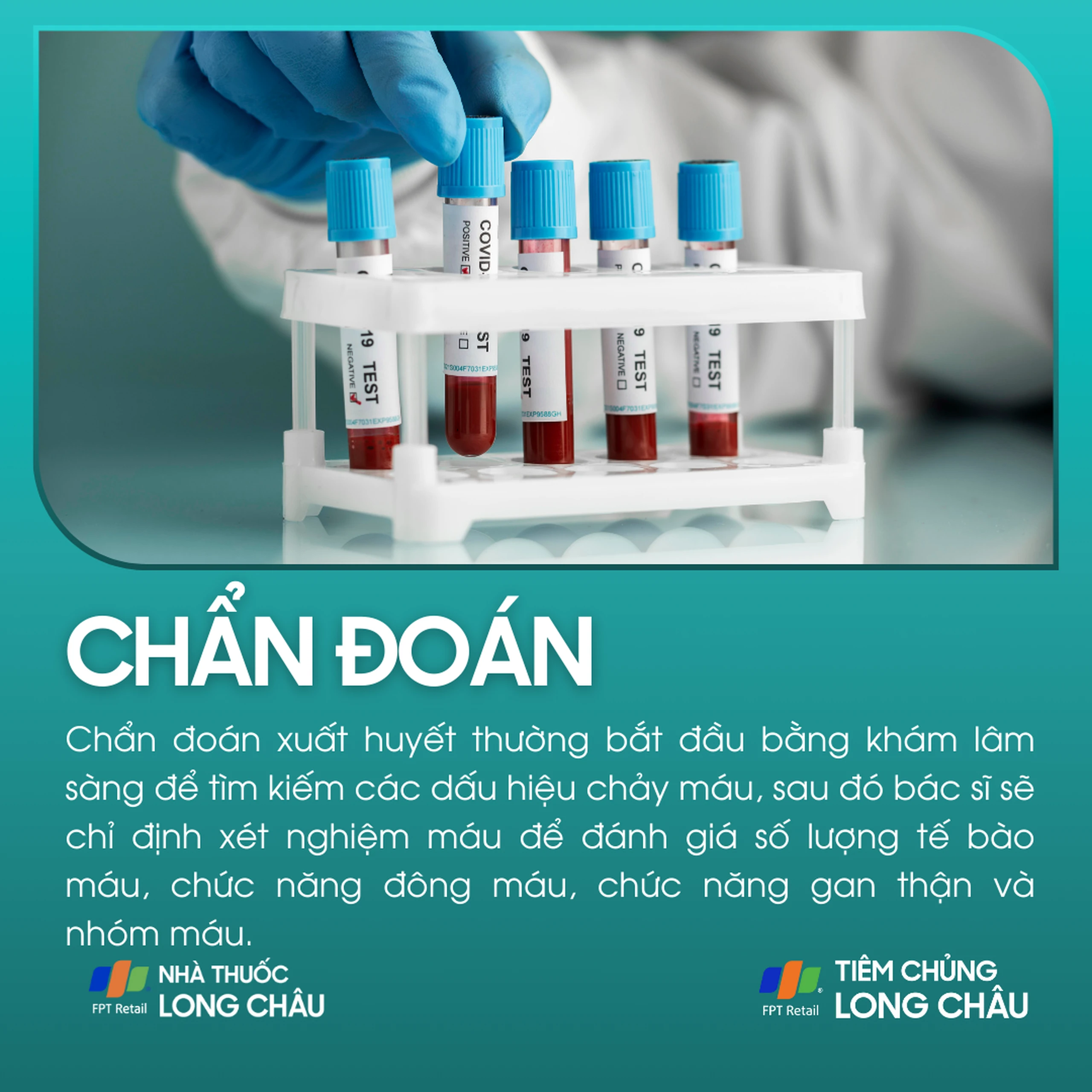 xuat_huyet_5_b9e66563bf