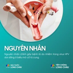 loan_san_co_tu_cung_3_cfb26e6faa