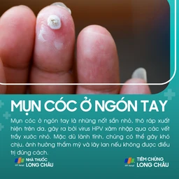 mun_coc_o_ngon_tay_1_43b3421c0d
