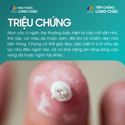 mun_coc_o_ngon_tay_2_522d6afcc5