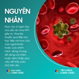mun_coc_o_ngon_tay_3_b8315b6f4f