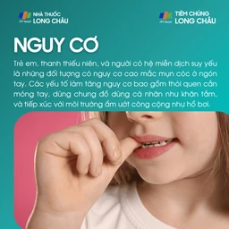 mun_coc_o_ngon_tay_4_a850b6da94