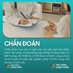 mun_coc_o_ngon_tay_5_75a68e2cde
