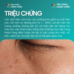 mun_coc_phang_2_7a84c84ea9