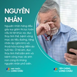 suy_giam_thi_luc_3_3e67e1a4d4