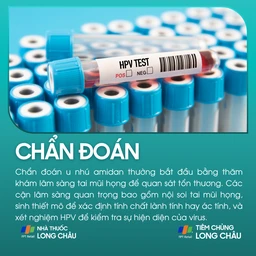 u_nhu_amidan_5_c473ee7226