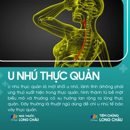 u_nhu_thuc_quan_1_f0bb3efa2e