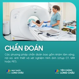 ung_thu_hau_hong_5_721a6e8108