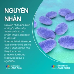 Viêm nắp thanh quản 3