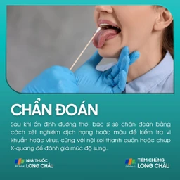 Viêm nắp thanh quản 5