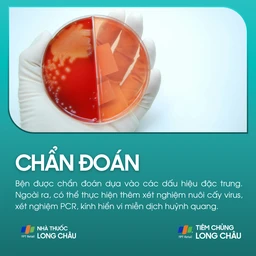zona_than_kinh_5_88a356b5af