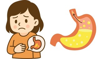 Trào ngược dạ dày thực quản ở trẻ em là gì? Khi nào cần đưa trẻ đi khám?
