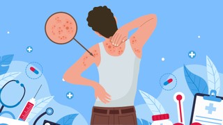 Đau sau zona có phải chỉ là “chuyện nhỏ” như nhiều người vẫn nghĩ?