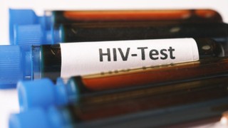 Xét nghiệm viêm gan B có phát hiện HIV không? Những điều cần biết