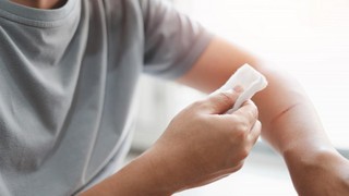 Xử lý khi bị động vật cắn đúng cách để phòng ngừa biến chứng